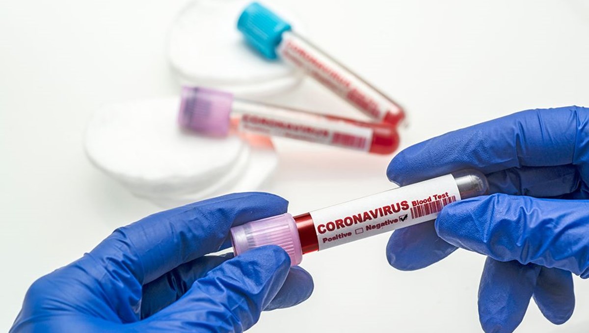 1 Ocak 2022 corona virüs tablosu: 145 can kaybı, 36 bin 731 yeni vaka