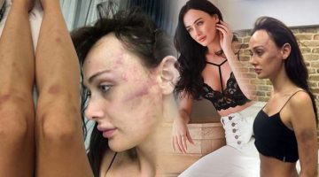 Sevgilisi Sırp model Tanja Dukiç’i dövdüğü iddia edilen yönetmen Çağrı Reşat Mehmet Tortop’un yaralama davasında karar